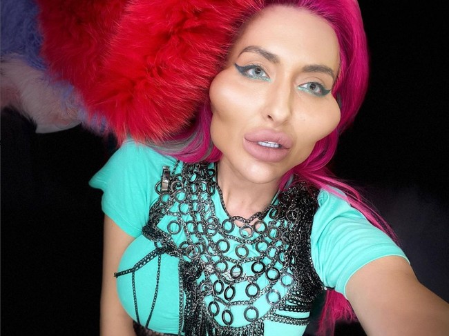 Anastasia Pokreshchuk ingin memiliki pipi besar dan lebar. Dia mewujudkan keinginannya itu dengan suntik filler pada kedua tulang pipinya. Foto: Instagram/@justqueen8888