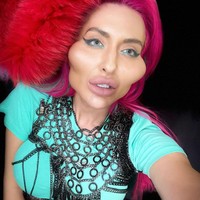 Anastasia Pokreshchuk ingin memiliki pipi besar dan lebar. Dia mewujudkan keinginannya itu dengan suntik filler pada kedua tulang pipinya. Foto: Instagram/@justqueen8888