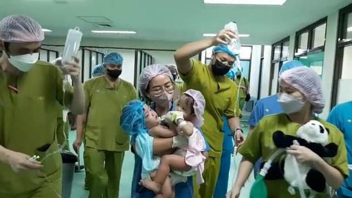 Bayi kembar siam asal KBB jalani operasi pemisahan di RSHS Bandung.