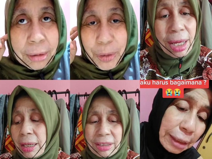 Wanita kelahiran tahun 1994 viral, mengalami penyakit langka. Wajahnya terlihat lebih tua dari usianya.