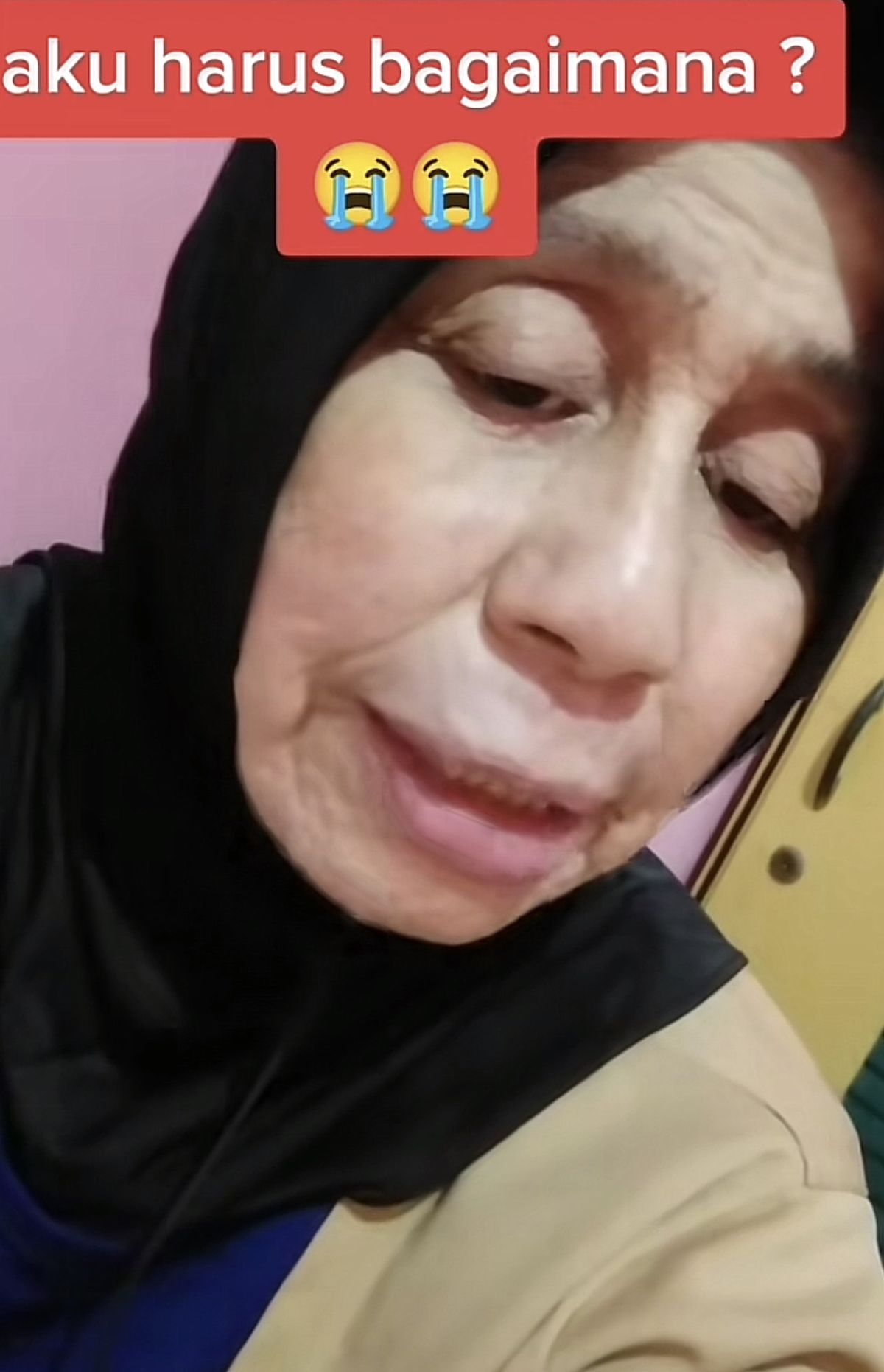 Cerita Wanita Viral Alami Penyakit Langka, Usia 28 Wajah bak Nenek-nenek