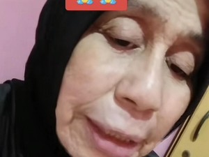 Cerita Wanita Viral Alami Penyakit Langka, Usia 28 Wajah bak Nenek-nenek