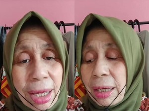 Viral Wanita Bogor Alami Penyakit Langka, Usia 28 Wajah bak Nenek-nenek