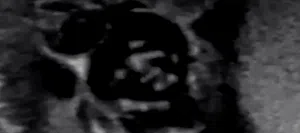 Duh! Video Parasit Goyang-goyang di Kantung Pelir Seorang Pria