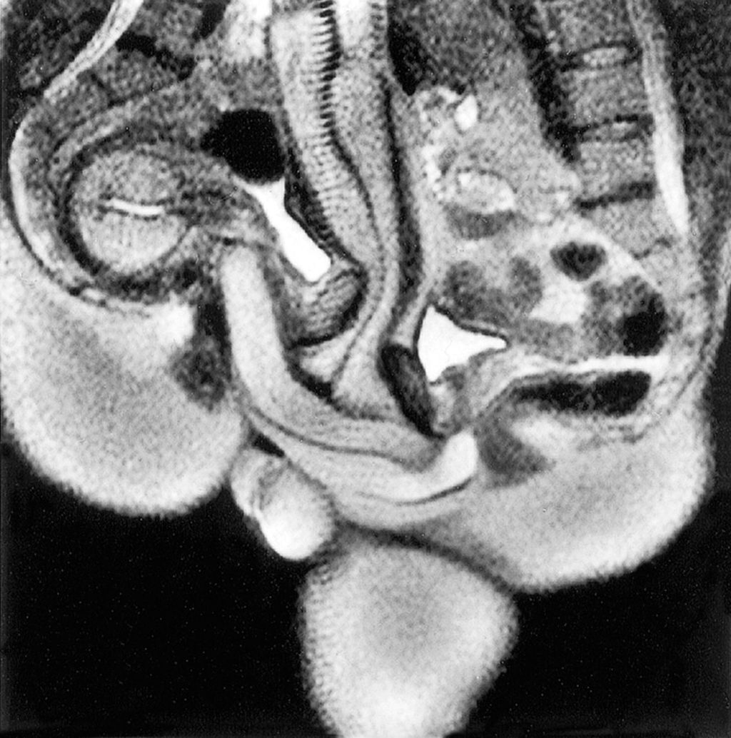 Viral Foto MRI Pasangan Bercinta, Jadi Jurnal Terpopuler Sepanjang Masa