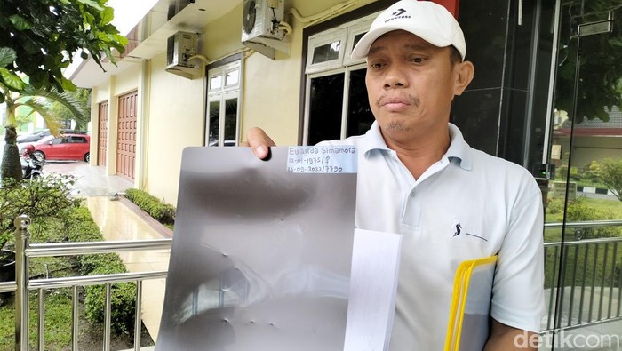 Reynold saat berada di Gedung Ditreskrimsus Polda Sumut. (Datuk Haris Molana/detikSumut)