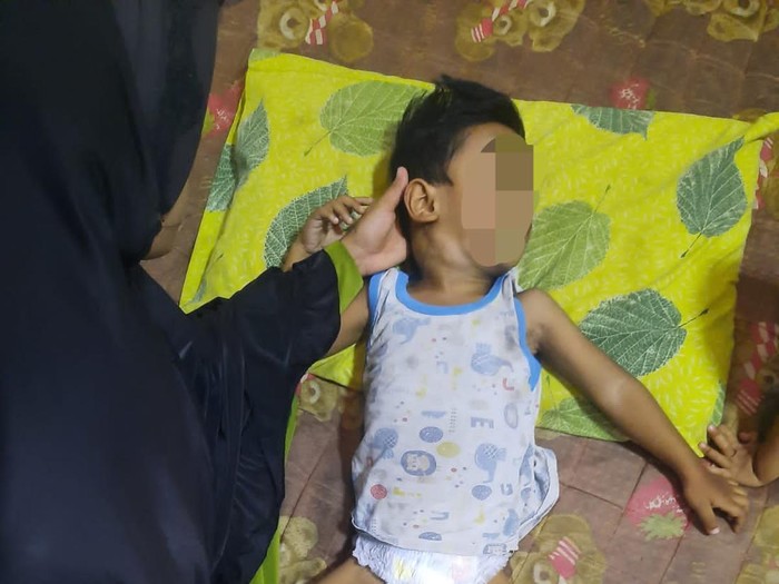 Bocah di Jambi mengalami kanker getah bening, M Zubair