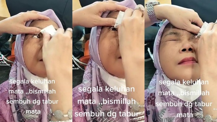 Viral Mata Katarak Disembuhkan Pakai Obat Bubuk, Dokter Singgung Risiko Kebutaan