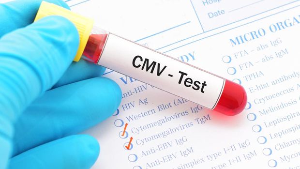 Ilustrasi Cytomegalovirus CMV