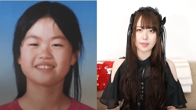 Todoroki tak segan membagikan wajah aslinya sebelum operasi plastik. Foto: Tangkapan Layar YouTube