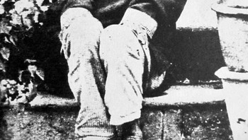 Pria dalam gambar tersebut adalah Dina Sanichar, yang diyakini secara luas dibesarkan oleh serigala. Dia lahir di India dan ditemukan di hutan lebat Uttar Pradesh oleh para pemburu pada tahun 1872. Mereka menemukannya sedang berburu di samping serigala dan mencatat bahwa dia berjalan dengan keempat anggota tubuhnya. Foto: Lostinhistorypics via Boredpanda
