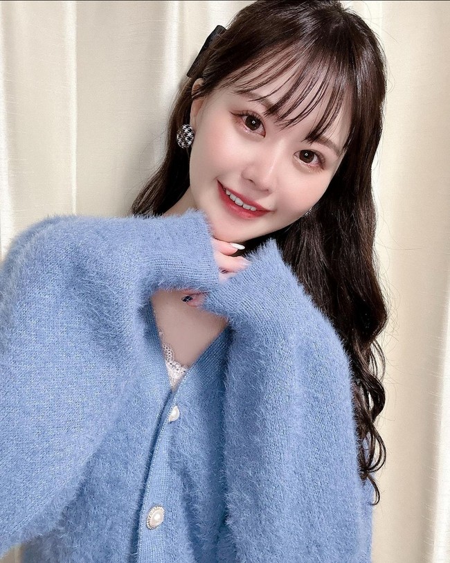 Operasi kelopak mata menjadi prosedur pertama yang dijalaninya. Dia juga operasi hidung dan rahang. Foto: Instagram/@todoroki.sk