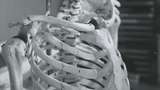 Fungsi Tulang Atas dan Gangguan yang Sering Terjadi