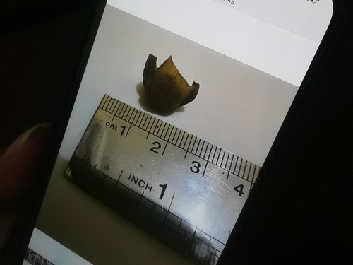 Penampakan potongan jari manusia dalam sayur lodeh di Kabupaten Belu, Nusa Tenggara Timur (NTT). (Yufen Ernesto)