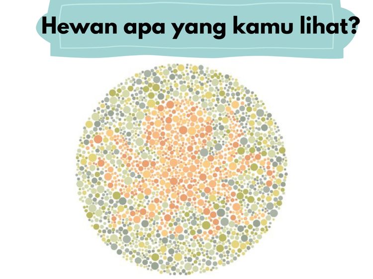 Soal Buta Warna Nggak Pakai Mikir, Harusnya Terjawab Kurang dari Semenit