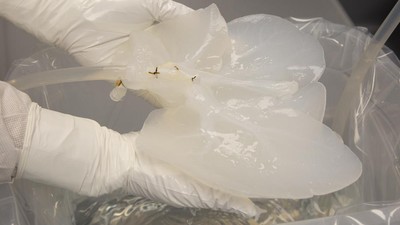 8 Foto Persiapan Ilmuwan Transplantasi Organ Hati-Ginjal Babi ke Manusia