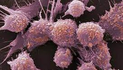 Ilustrasi Penyakit Kanker.