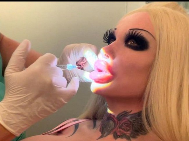 Kitty pun mengaku semakin penampilannya palsu, maka dia semakin puas. Seperti bibirnya yang baru-baru ini ditambahkan lagi filler, bahkan bibirnya kini lebih maju dibanding hidungnya. Foto: dok. Instagram