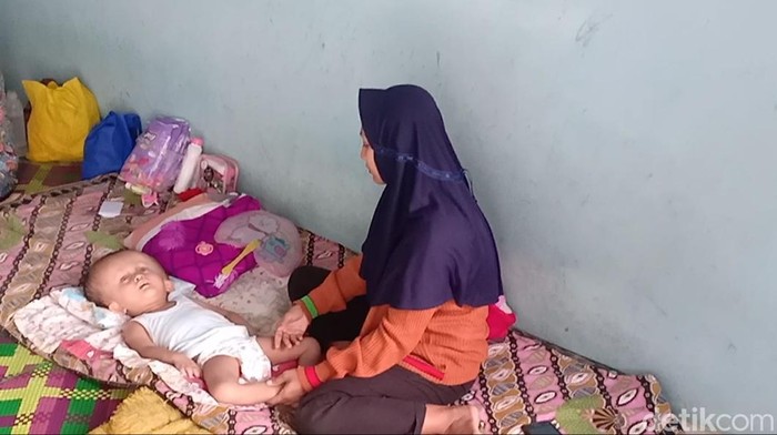 Kondisi bocah yang mengidap hidrosefalus di Jambi