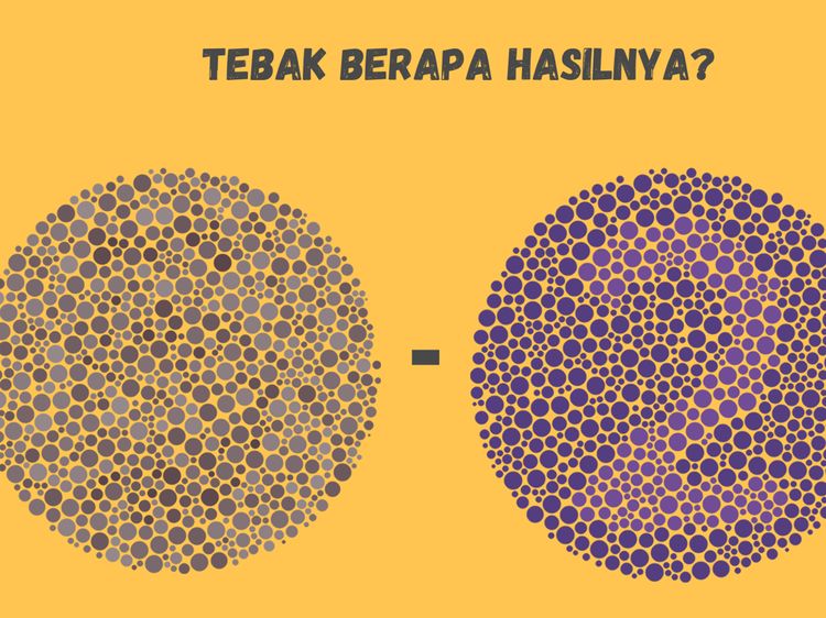 Bisa Tebak Berapa Hasil Perhitungan Ini? Kalau Gagal, Tandanya Harus Cek Mata
