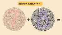 Soal kedua, angka berapa yang kamu lihat? Berapa jawabannya? (Foto: DetikHealth).