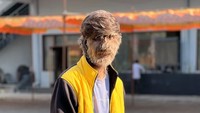 Penyakit yang juga dikenal sebagai sindrom manusia serigala ini juga sangat sangat langka. Hingga saat ini, dunia hanya mencatat kurang dari 100 kasus hipertrikosis. (Foto: Instagram@lalitpatidar520)