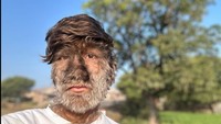 Seorang remaja dari India, Lalit Patidar, mengidap kondisi langka yang membuat area wajah dan sekujur tubuhnya ditumbuhi rambut tebal. Diketahui, Patidar telah mengidap kondisi ini sejak ia lahir. (Foto: Instagram@lalitpatidar520)