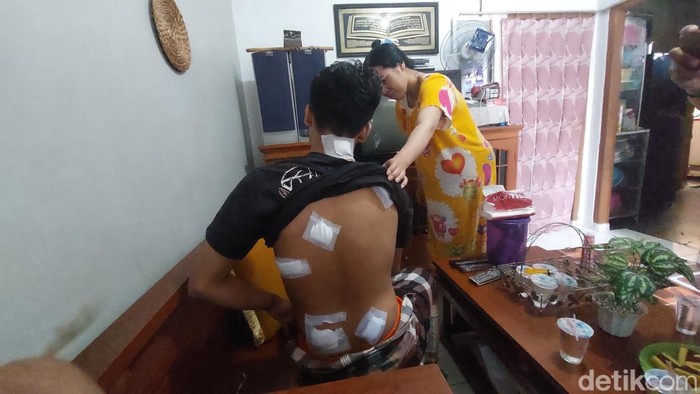 Luka-luka korban geng motor di Cimahi.