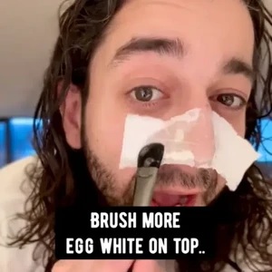 Viral Hilangkan Komedo Pakai Telur, Pakar Kecantikan Menentangnya Viral Hilangkan Komedo Pakai Telur, Pakar Kecantikan Menentangnya