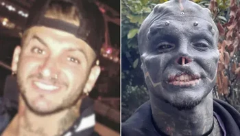 Ia adalah Anthony Loffredo yang berubah menjadi The Black Alien. Foto: via NDTV