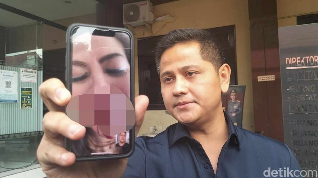 Hidung Venna Melinda Reza Mahastra