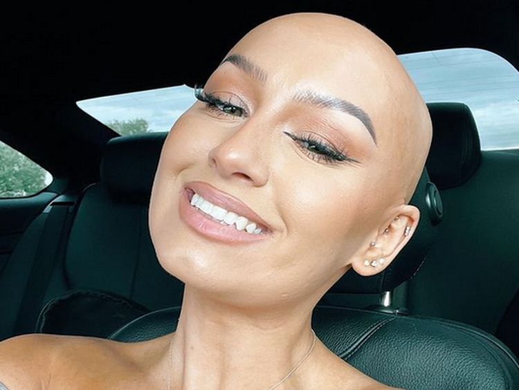 8 Potret Beauty Influencer Berkepala Botak Ingin Dobrak Standar Kecantikan
