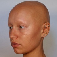 Wanita 24 tahun itu mengalami alopecia sejak bayi dengan garis rambut ke belakang. Semakin lama rambutnya makin rontok hingga menjadi botak.Foto: dok. Instagram