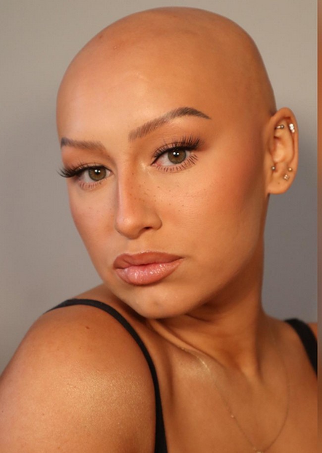 Dani mengatakan bahwa menerima penampilan naturalnya sangat sulit pada awalnya. Namun akhirnya dia menemukan kenyamanan dengan makeup dan akhirnya bisa menerima kondisinya.Foto: dok. Instagram