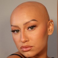 Dani mengatakan bahwa menerima penampilan naturalnya sangat sulit pada awalnya. Namun akhirnya dia menemukan kenyamanan dengan makeup dan akhirnya bisa menerima kondisinya.Foto: dok. Instagram