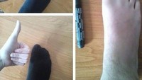 Kaos kaki bolong tidak perlu dijahit. Pakai spidol saja di bagian yang berlubang. Foto: Dok. Brightside