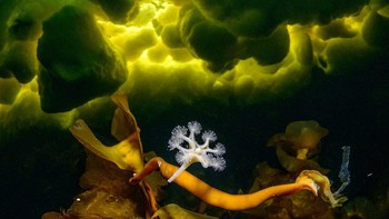 Foto karya Viktor Lyagushkin dari Georgia. Ini adalah Lucernaria quadricornis (Stauromedusae) , ubur-ubur bertangkai, difoto di bawah es Laut Putih di Rusia – satu-satunya laut beku di Eropa. Warna hijau air merupakan tanda musim semi saat ganggang tumbuh. Foto: Close-up Photographer of the Year Awards