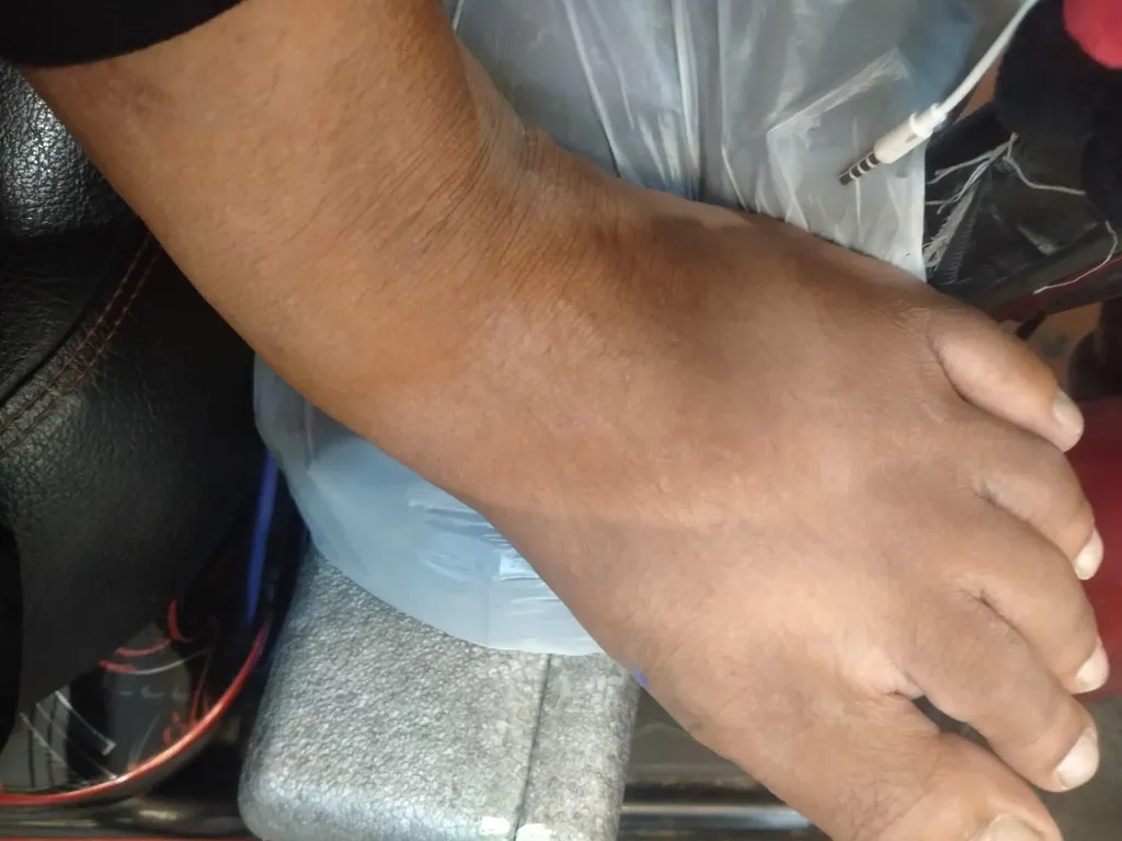 Tega! Pelanggan Paksa Ojol Disabilitas Antar Makanan ke Lantai 2