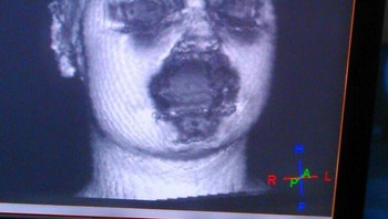 Beginilah Bentuk Rekonstruksi 3D Mri Wajah Anda Saat Anda Memakai Riasan. Partikel Logam Di Maskara Anda Dll Mengganggu Sinyal Mesin MRI Foto: Boredpanda 