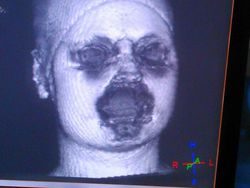 Deretan Foto Mengerikan Bikin Bergidik Melihatnya