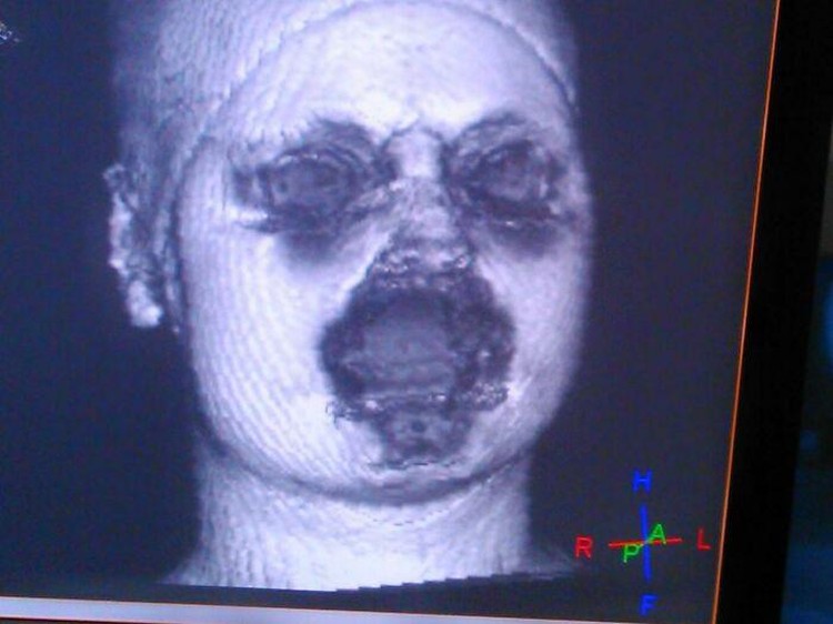 Foto menyeramkan bikin bergidik