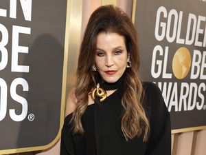 Penyebab Kematian Lisa Marie Presley Terungkap, Ada Kondisi Usus Tersumbat-Pecah