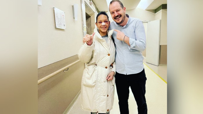 Muncul dengan Wajah dan Mata Lebam, Bunda Corla Operasi Plastik?