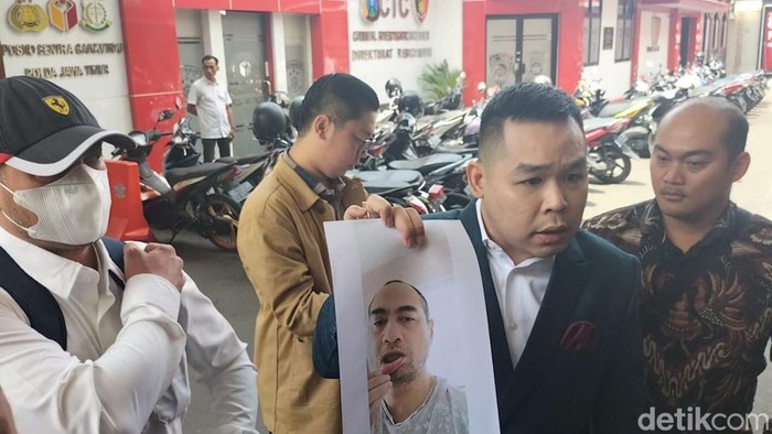 Ferry Irawan saat didampingi Jeffry Simatupang