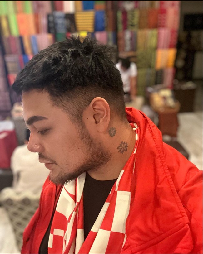 Setelah menjalani operasi plastik, hidung Ivan Gunawan pun terlihat semakin mancung dan kecil. Diketahui jika itu bukanlah oplas hidung pertama Ivan. Sebelumnya Ivan juga pernah menjalani operasi plastik pada hidungnya di Korea Selatan. Foto: Instagram/@ivan_gunawan