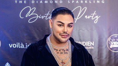 8 Foto Wajah Baru Ivan Gunawan Usai Oplas Hidung, Disebut Mirip Aktor Turki