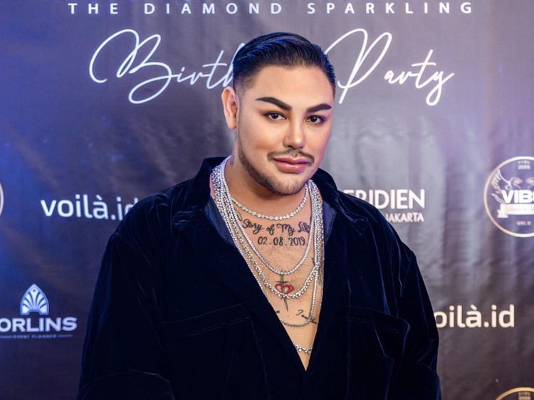 8 Foto Wajah Baru Ivan Gunawan Usai Oplas Hidung, Disebut Mirip Aktor Turki