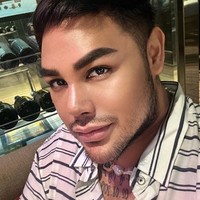 Melalui akun Instagram pribadinya Ivan Gunawan mengungkapkan jika dirinya menjalani operasi plastik pada hidungnya saat berada di Turki. Setelah operasi pria yang akrab disapa Igun itu terlihat sempat berjalan-jalan di Turki dengan hidung yang diperban. Namun kini perban hidungnya tersebut sudah dibuka. Foto: Instagram/@ivan_gunawan