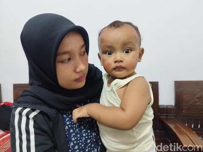 Ibu dan balitanya mengalami luka akibat percobaan penjambretan di Tanjungsari Surabaya