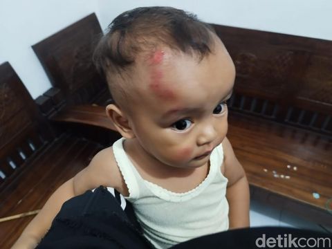 Ibu dan balitanya mengalami luka akibat percobaan penjambretan di Tanjungsari Surabaya